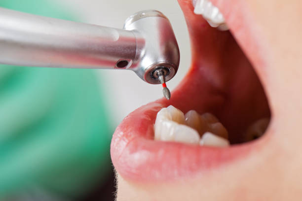 Best Emergency Cosmetic Dentistry in Fish Hawk, FL